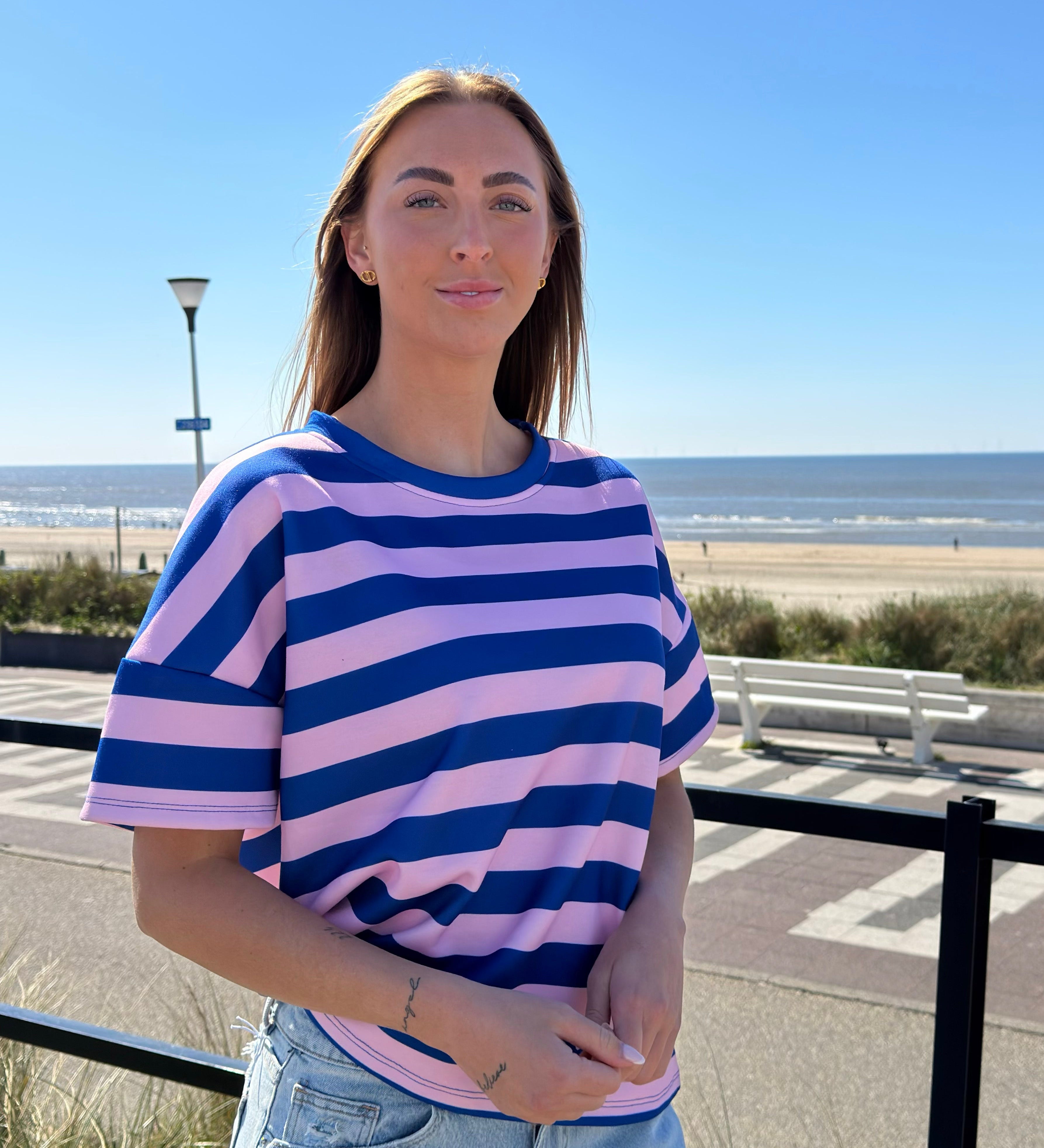 Hope | Ing csíkos mintával