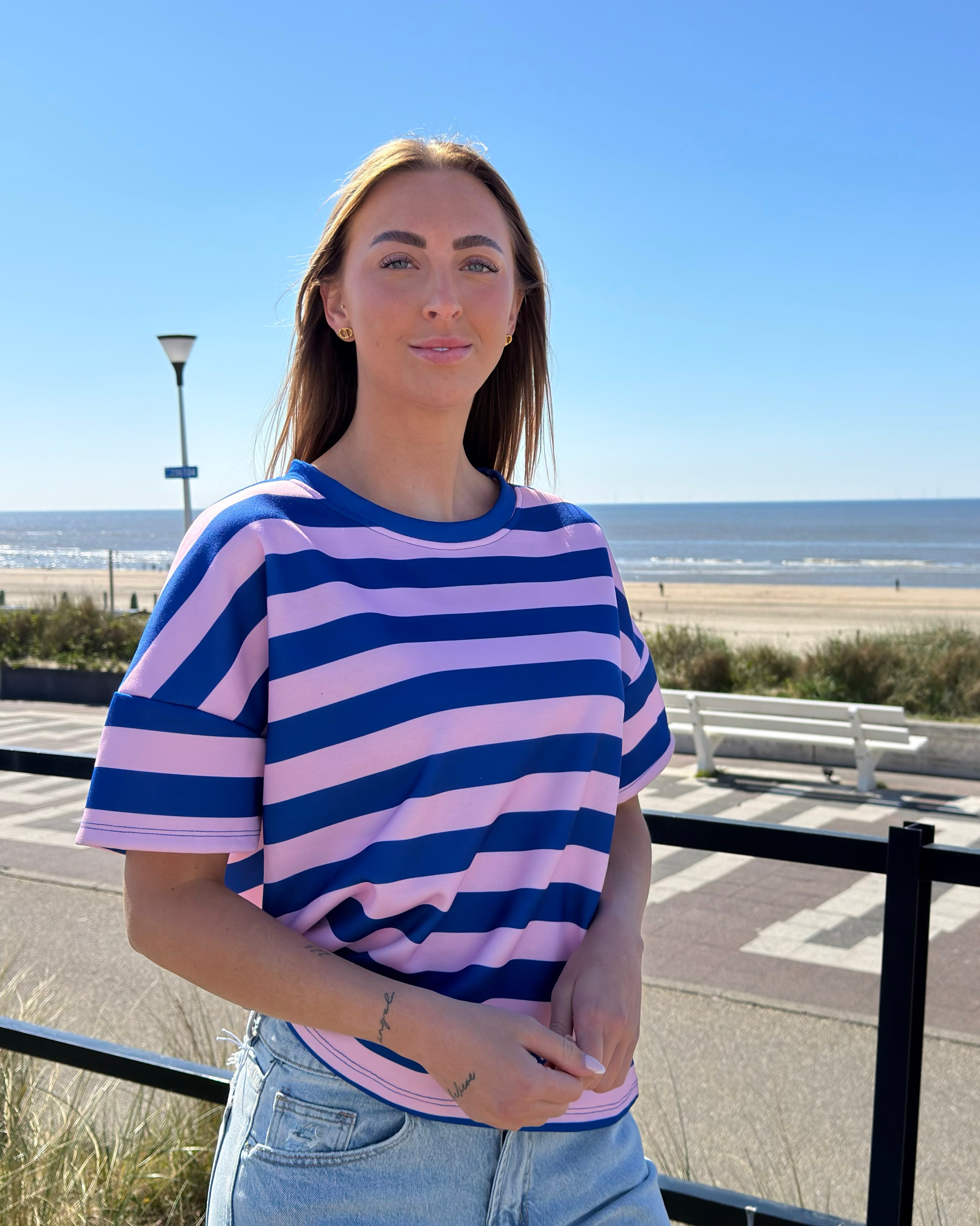 Hope | Ing csíkos mintával